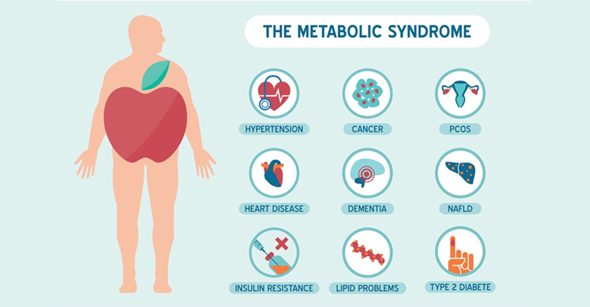 metabolic-syndrome-workup-treatment