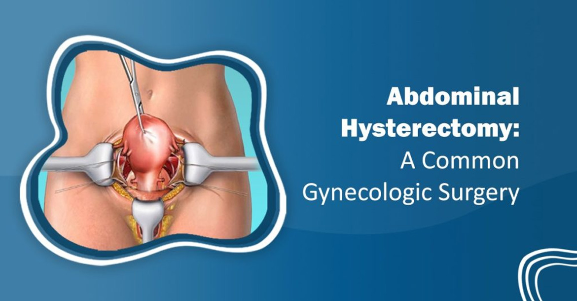 open-hysterectomy